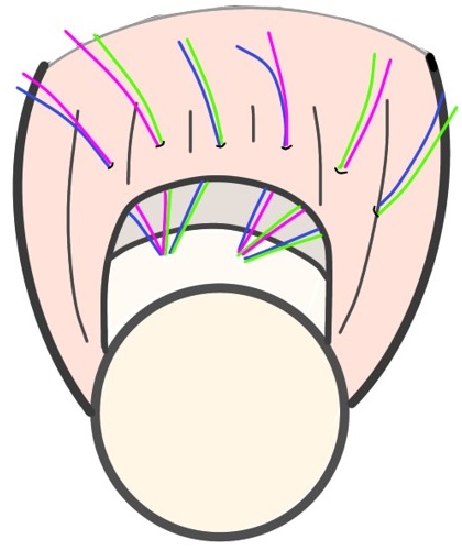 糸をかける図