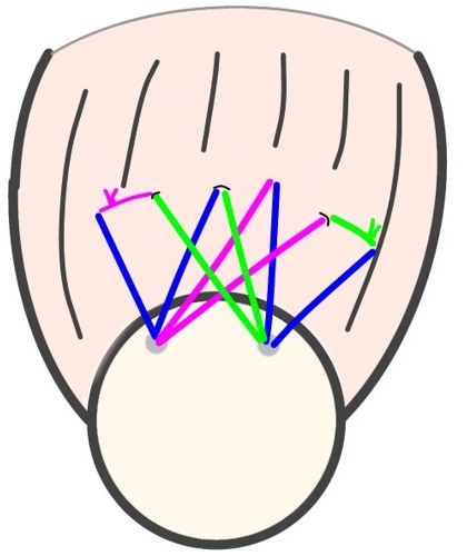 糸の固定図